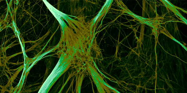 Stem-cells-and-Neurodegenerative-diseases