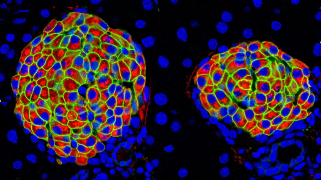 Un pàncrees embrionari de 18 dies, tenyit amb insulina en vermell, glucagó en verd i una proteïna que es troba en els conductes pancreàtics en blau. Imatges obtingudes mitjançant tomografia de projecció òptica. Crèdit: Miguel Angel Mestre/CRG