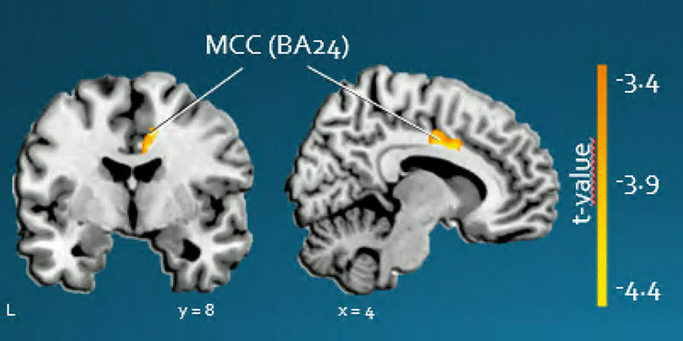 NP15 - E Camara_Disorders Moviment - Imatge