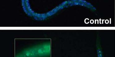 recurso-paper-Retinitis-2